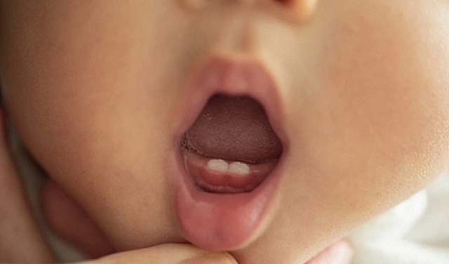 دليلك الشامل عن الأسنان التي يولد بها الأطفال
