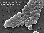 باحثون يكتشفون مضادا حيويا مكافحا للبكتيريا المُقاوِمة للأدوية