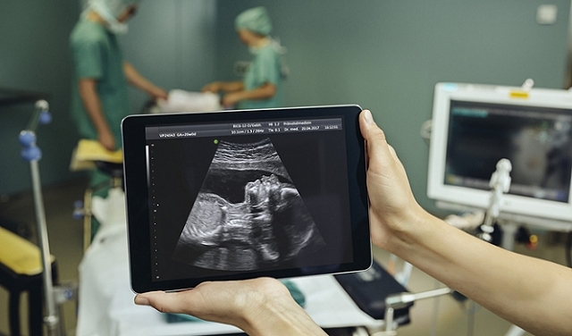 أطبّاء فرنسيّون ينجحون بإجراء عمليّة لدماغ جنين خلال الحمل