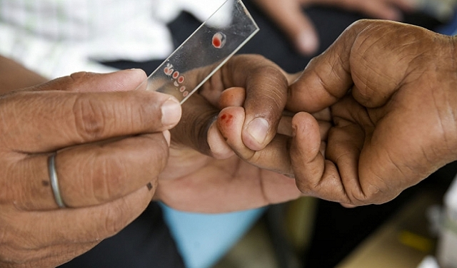 لأول مرة منذ 20 عامًا: حالات الملاريا في الولايات المتحدة