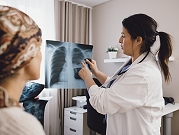 دراسة: الذكاء الاصطناعي قد يخفف على الأطباء في فحوصات سرطان الثدي