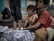 مستشفيات غزة.. ممرّات مكتظّة بالجرحى وعمليّات دون تخدير