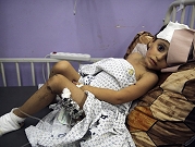 بالصرخات والآلام والأدعية: عمليات جراحية في مستشفيات غزة بدون تخدير