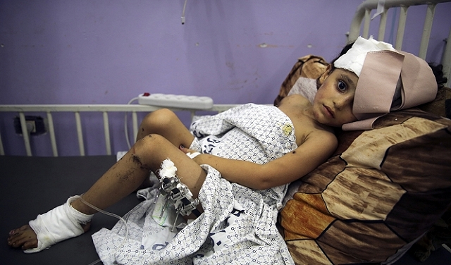 بالصرخات والآلام والأدعية: عمليات جراحية في مستشفيات غزة بدون تخدير