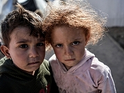 نحو 10 أطفال من غزّة يفقدون سيقانهم يوميًّا