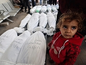 الأونروا: الحرب الدائرة منذ 100 يوم بغزة تلطخ إنسانيتنا