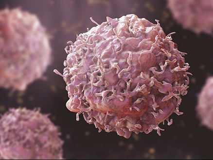 منظّمة الصحّة العالميّة: الإصابات الجديدة بالسرطان سترتفع 77% بحلول 2050