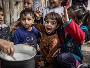 تدهور غير مسبوق عالميًّا: وكالات الأمم المتحدة تحذر من "انفجار" في عدد وفيات الأطفال في غزة