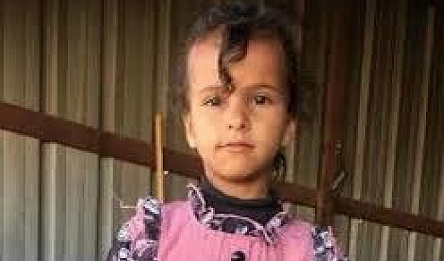 بعد إصابتها بشظية صاروخية ليلة الهجوم الإيراني: تحسن طفيف على حالة الطفلة من النقب