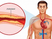 دليلك الشامل عن الكوليسترول في الدم وكيف نستطيع ضبط مستوياته ضمن الحدود الطبيعية